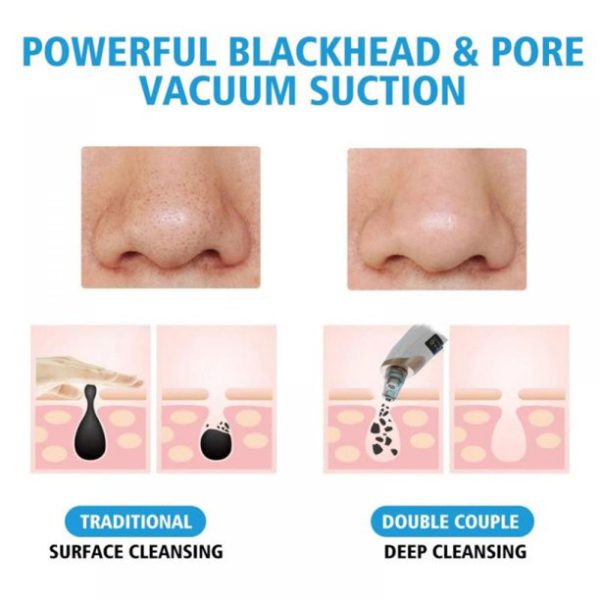 Electric Suction Blackhead Instrument Home Beauty Instrument Blackhead Pore Cleaning (rechargable).